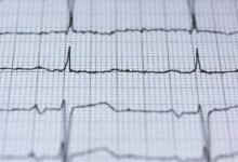 dynamic infinity circuit design